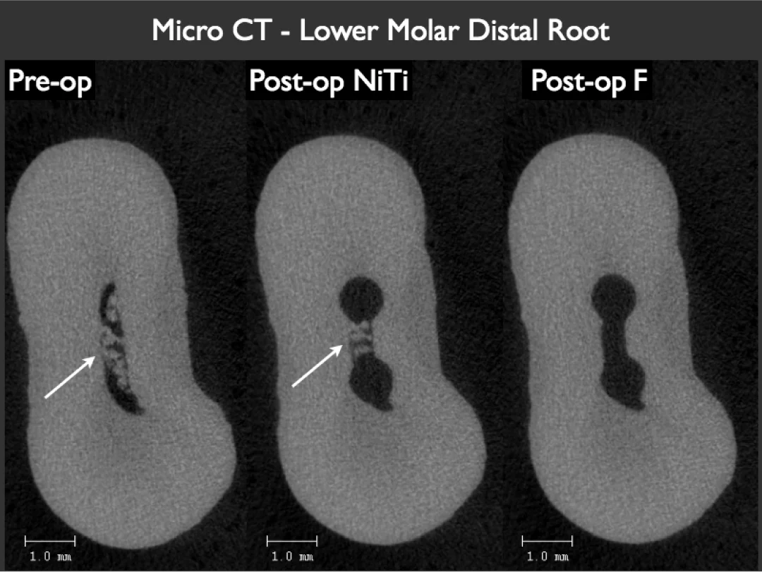 Micro